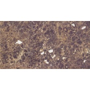 Настенная плитка Rocersa ceramic Marmi Emperador Marron-2