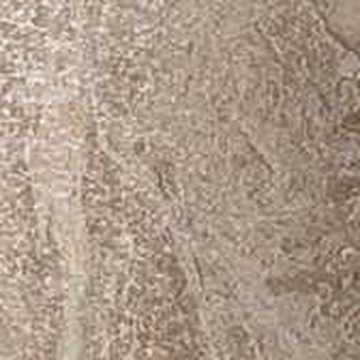 Atlas Concorde Russia Privilege 610090000765 Bottone Grigio Lapp Вставка 7,2x7,2 см, Россия - фото 1